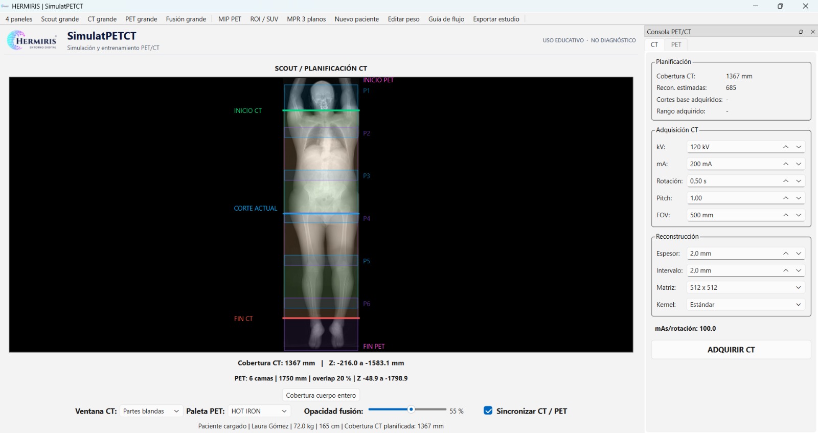 SimulatPETCT